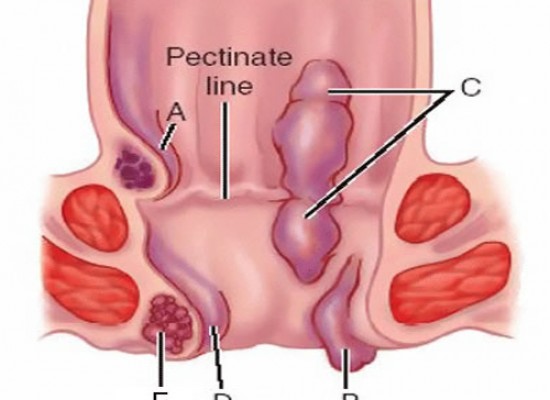Klinički pregled gastroenterologa sa ultrazvukom Abdomena u Poliklinici na Dedinju