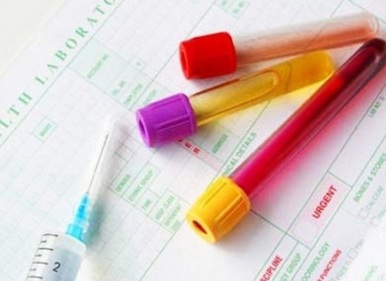 Kompletna laboratorijska analizu krvi i urina !
