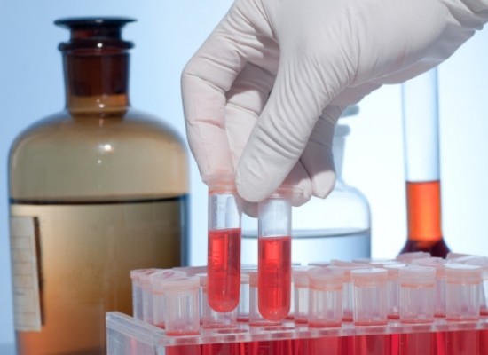 Kompletna biohemijska analiza krvi !