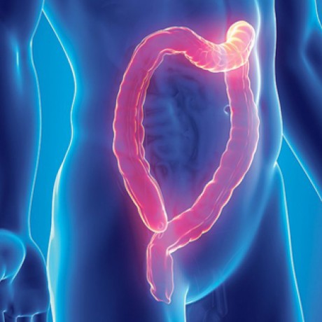 Pregled debelog creva kolonoskopijom u poliklinici na Vracaru!